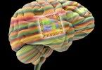 1453208956_11-brain-implant-corbis