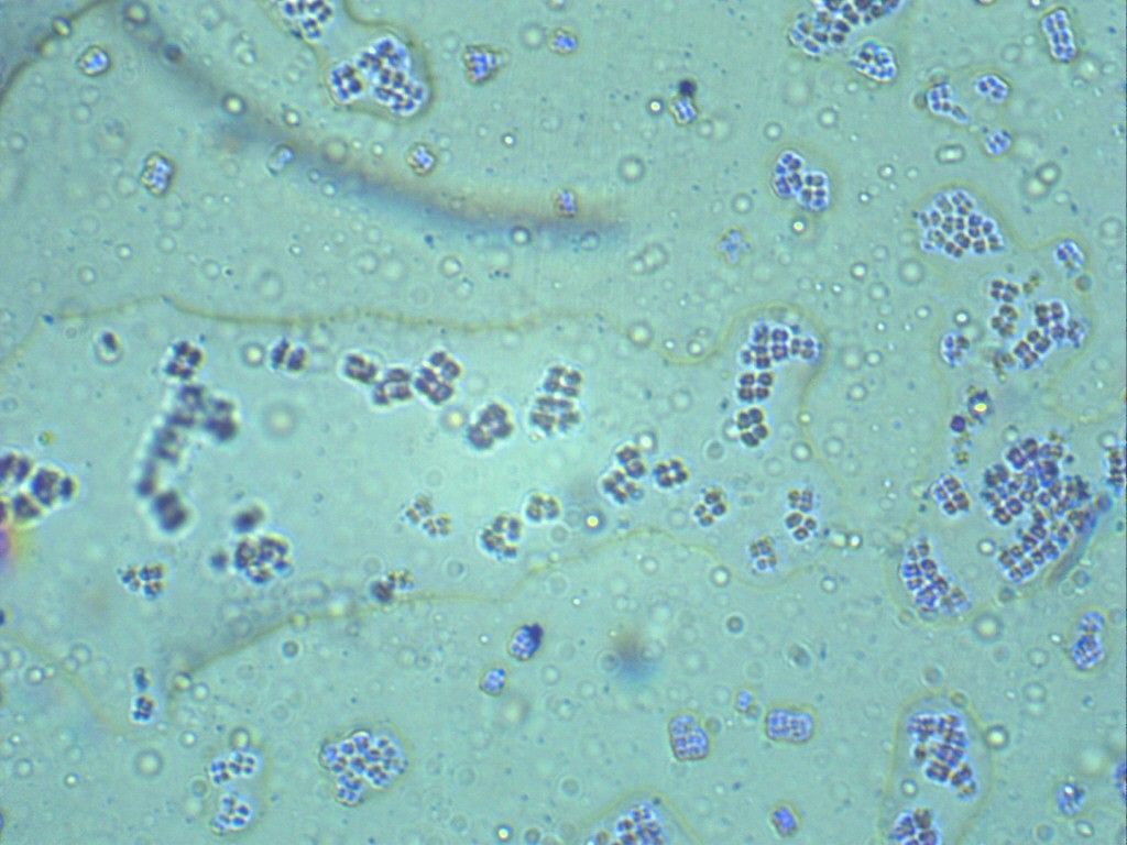 Тетракокки Nesseria под световым микроскопом под увеличением 100*10.