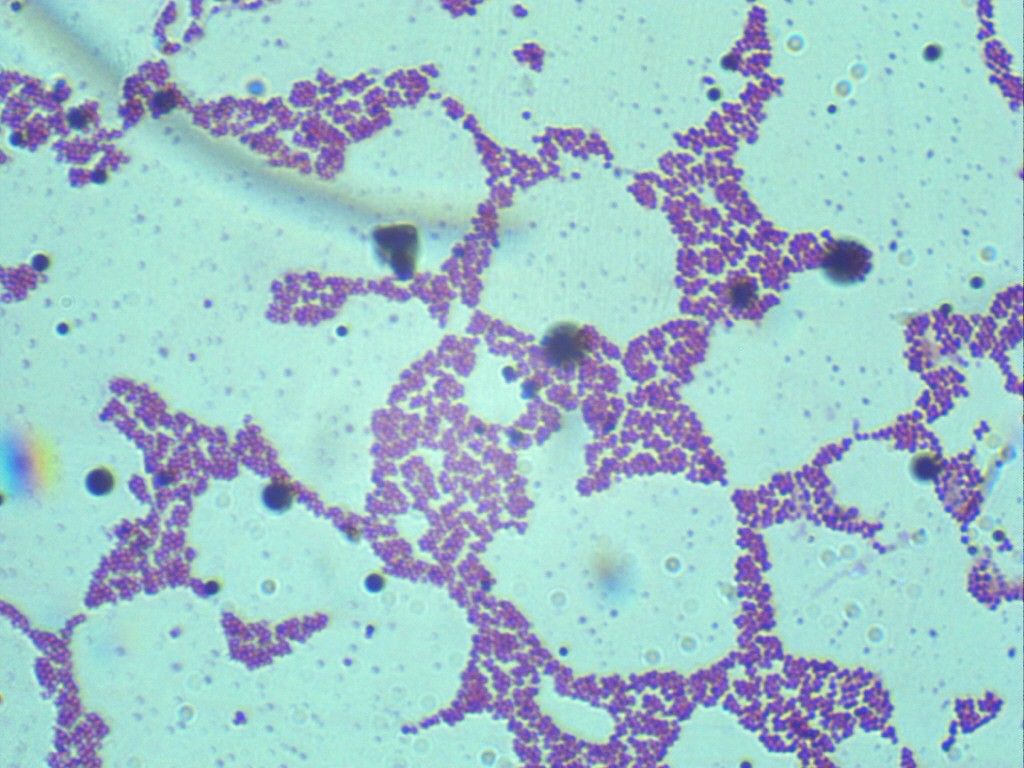 Колония Staphylococcus под световым микроскопом, увеличение 100*10. грамположительная колония, фиолетовый цвет. 