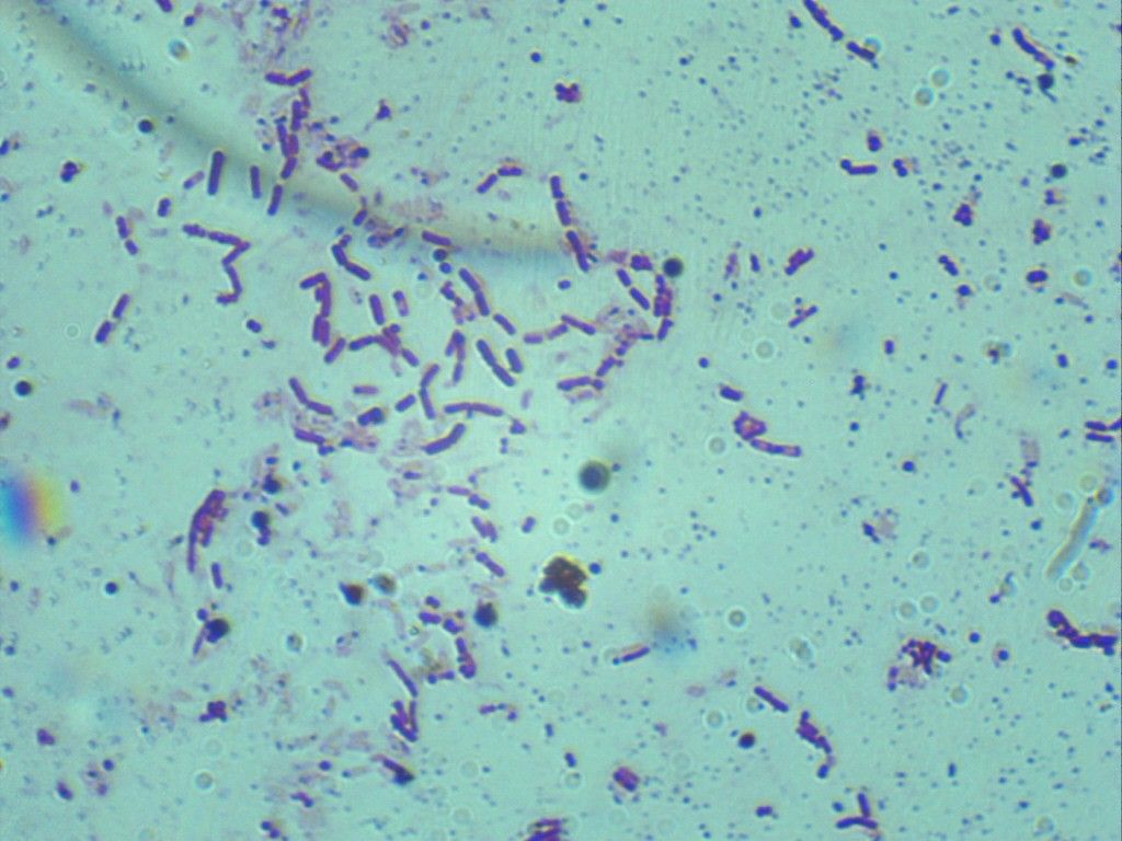 Грам-отрицательные бациллы под световым микроскопом, увеличение 100*10. Колонии розового цвета. 
