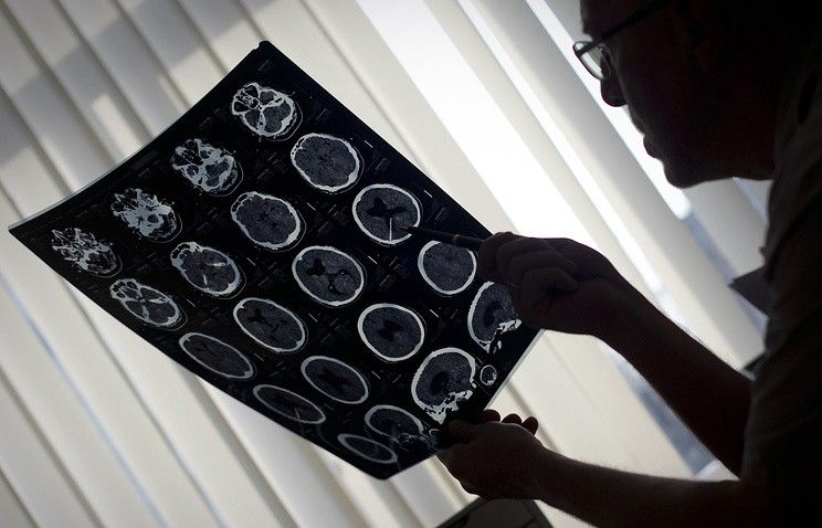 мозг медицина томография